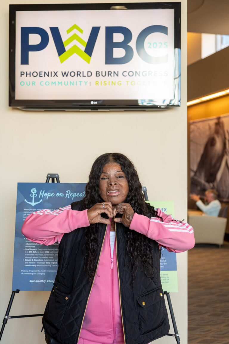 Attendee posing with the Phoenix World Burn Congress sign at the convention center